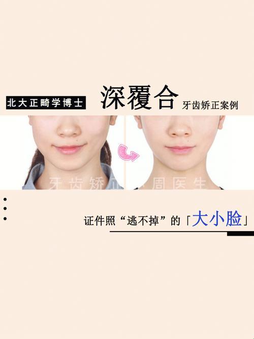 颌骨不对称，原是“天公不作美”？