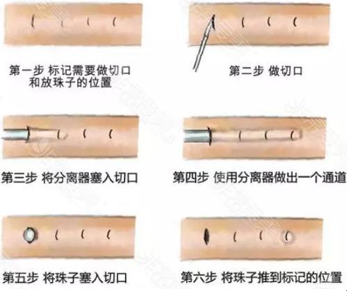 “男性植入珍珠，搞毛啊？”：一场现象级网络辩论的荒诞探秘