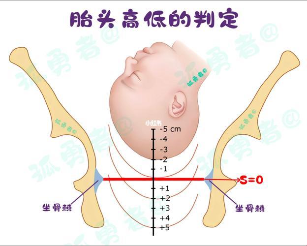 "嘶哑胎头纯生，幽默难产文学引爆"