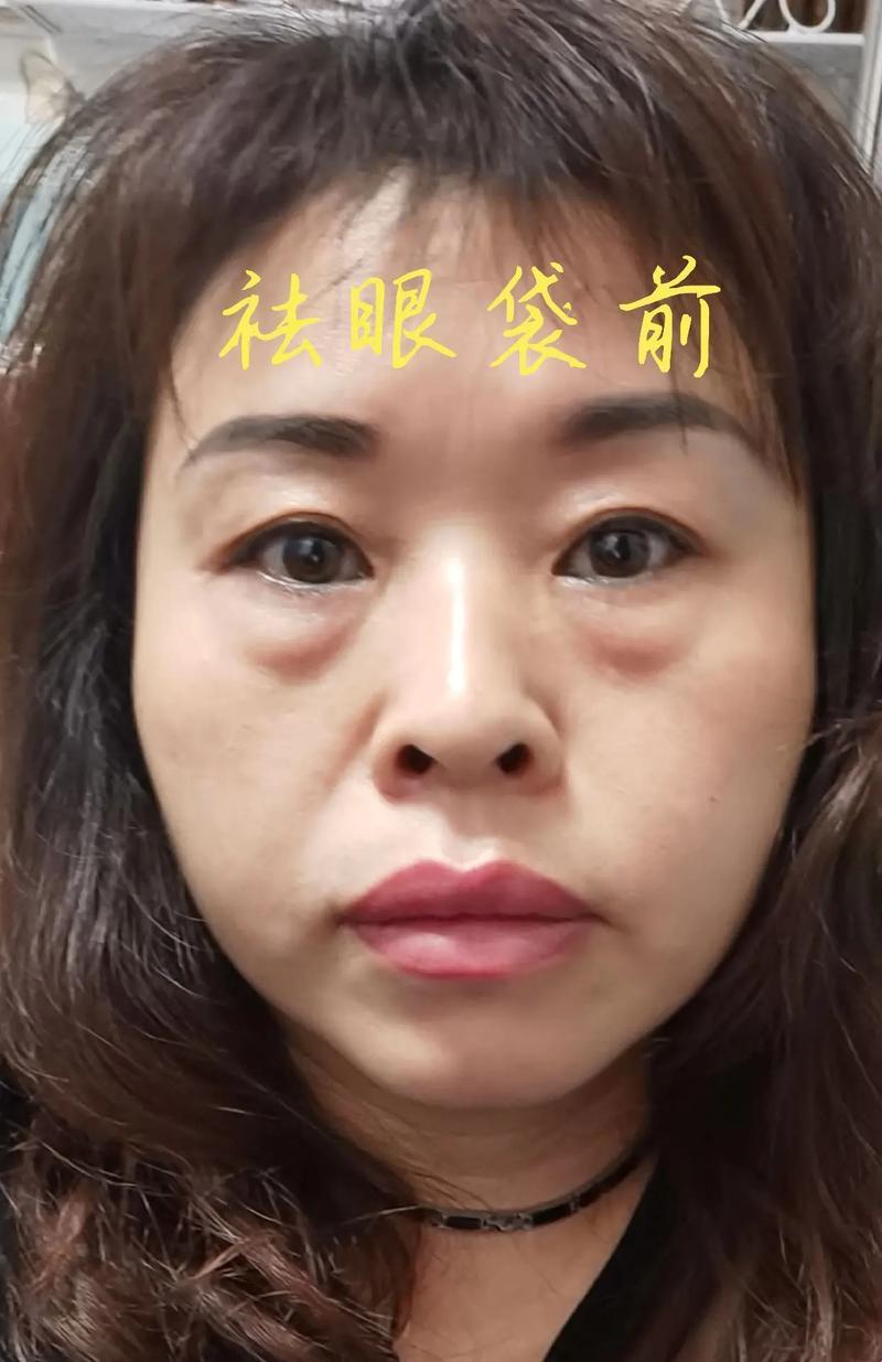 熟女眼袋，时间的痕迹还是美丽的误会？